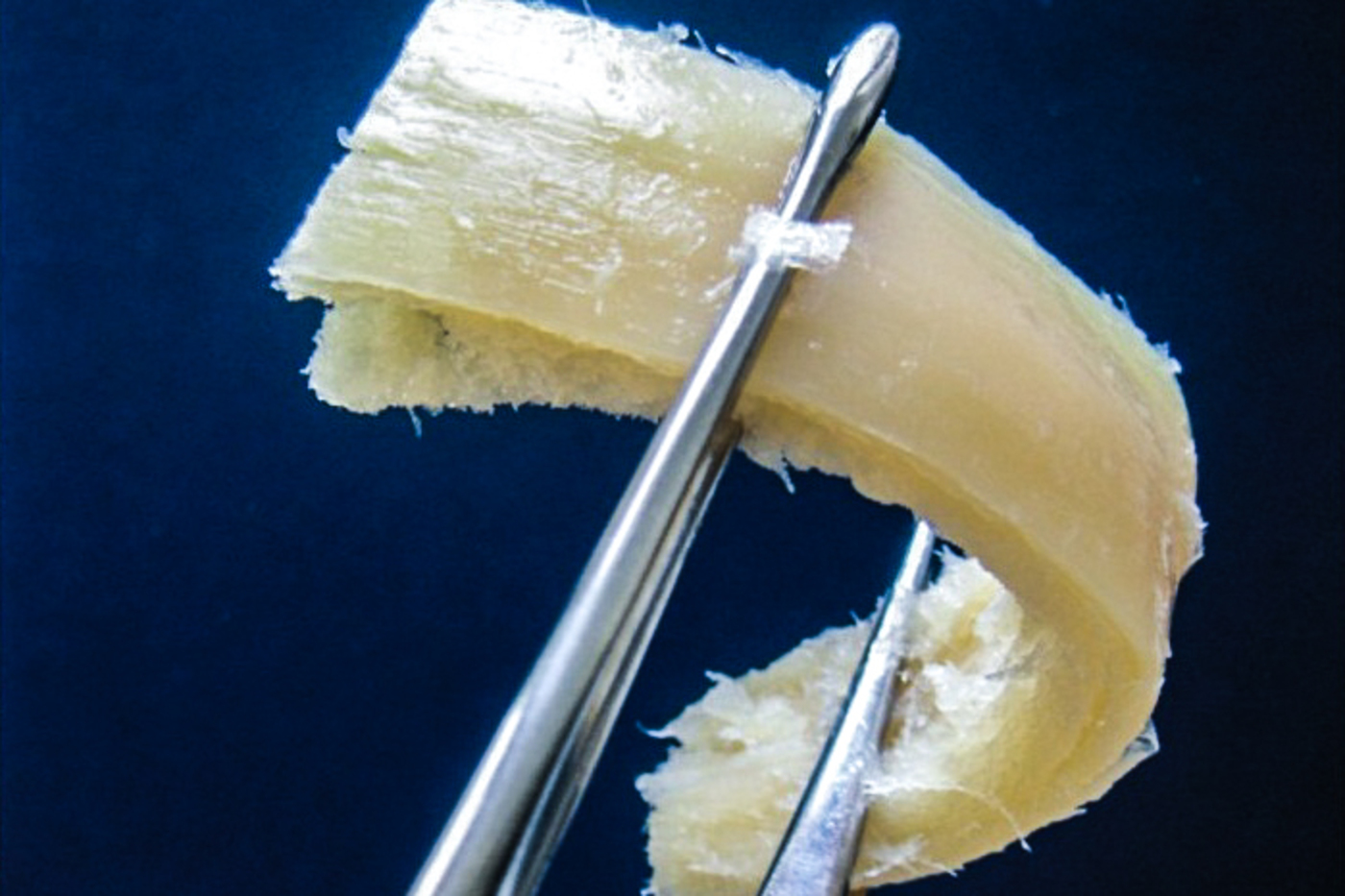 Стерильная кость. Костный блок Лиопласт. Костный аллотрансплантат. Костный материал в стоматологии. Аллогенный костный материал.