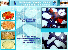 Постадийная очистка материала по технологии Лиопласт