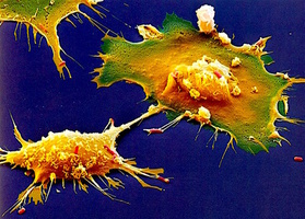 Some scientific facts that formed the basis of the approach to working with Lyoplast