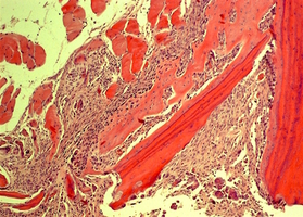 Biological properties of materials and patient tissue replacement