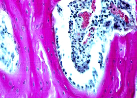 Allogeneic materials. Qualities, biological affinity and properties