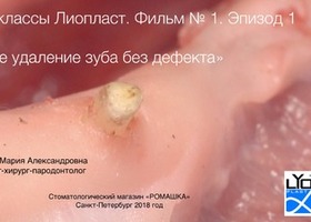 Operation 1. Preservation of the tooth hole during removal of the root or destroyed tooth