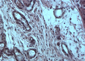 Mix-MAX Lyoplast: Pharmacotherapeutic Vascularization Induction