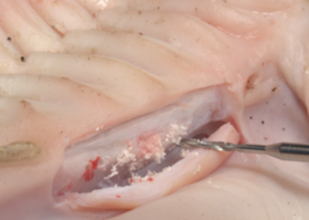 Operation 10. Implantation in the first type of bone tissue. Surgical training