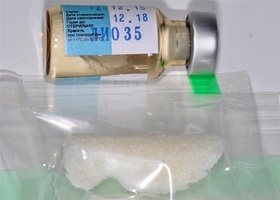 Operation 21. 3D plastic surgery of al-veolar Individual bone block RBB