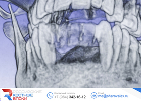 RBB # 0. Frontal portion of the lower jaw