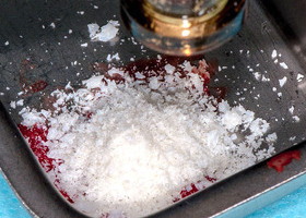 Removal of teeth and roots, alveolar plastics, NTR, together with implantation No. 1