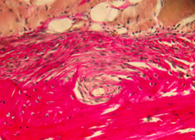 Morphological and laboratory substantiation of the use of combined grafts in bone grafting of the jaws