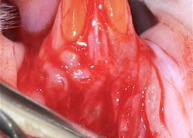Creating an in vivo experimental model for studying the surgical technique in a two-layer method for the treatment of multiple recessions